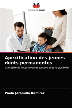Paperback Apexification des jeunes dents permanentes [French] Book