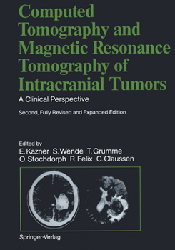 Paperback Computed Tomography and Magnetic Resonance Tomography of Intracranial Tumors: A Clinical Perspective Book