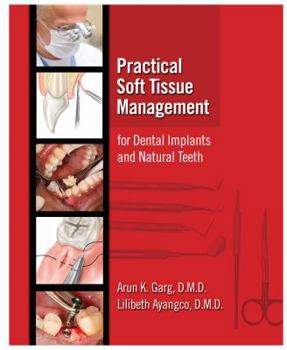 Hardcover Practical Soft Tissue Management for Dental Implants and Natural Teeth Book
