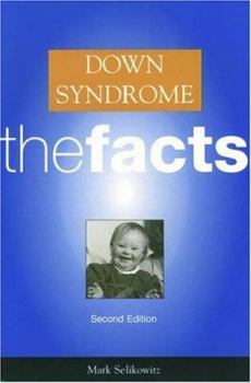 Paperback Down Syndrome: the Facts Book