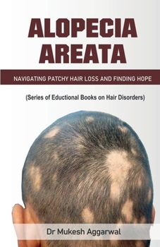 Paperback Alopecia Areata Book