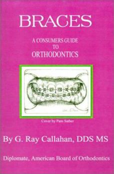 Paperback Braces: A Consumers Guide to Orthodontics Book