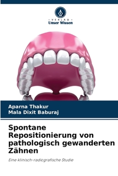 Paperback Spontane Repositionierung von pathologisch gewanderten Zähnen [German] Book