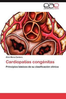 Paperback Cardiopatias Congenitas [Spanish] Book