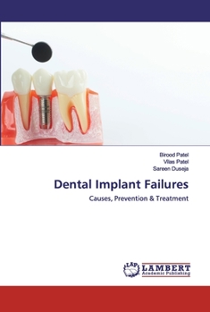 Paperback Dental Implant Failures Book