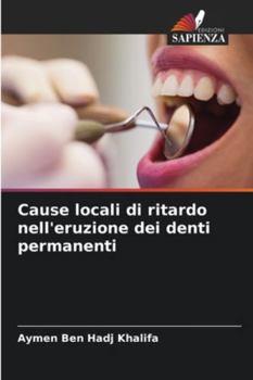 Paperback Cause locali di ritardo nell'eruzione dei denti permanenti [Italian] Book