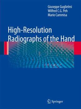 Paperback High-Resolution Radiographs of the Hand Book