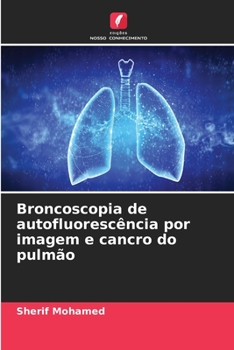 Paperback Broncoscopia de autofluorescência por imagem e cancro do pulmão [Portuguese] Book