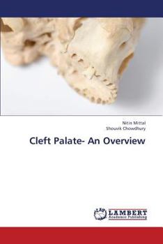 Paperback Cleft Palate- An Overview Book