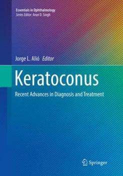 Paperback Keratoconus: Recent Advances in Diagnosis and Treatment Book