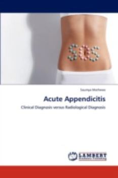 Paperback Acute Appendicitis Book