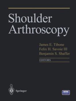 Paperback Shoulder Arthroscopy Book