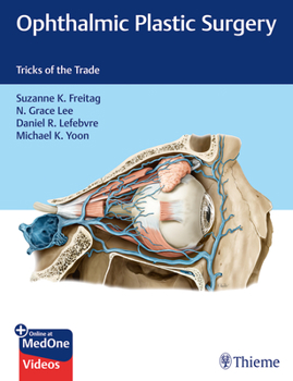 Hardcover Ophthalmic Plastic Surgery: Tricks of the Trade Book