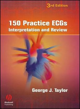 Spiral-bound 150 Practice Ecgs: Interpretation and Review Book