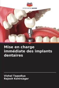 Paperback Mise en charge immédiate des implants dentaires [French] Book