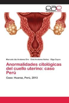 Paperback Anormalidades citológicas del cuello uterino: caso Perú [Spanish] Book