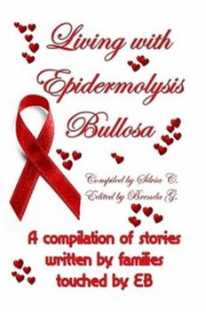 Paperback Living with Epidermolysis Bullosa Book