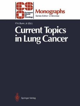 Paperback Current Topics in Lung Cancer Book