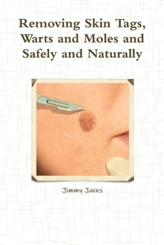 Paperback Removing Skin Tags, Warts and Moles and Safely and Naturally Book