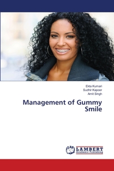 Paperback Management of Gummy Smile Book