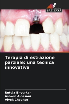 Paperback Terapia di estrazione parziale: una tecnica innovativa [Italian] Book