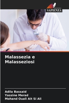 Paperback Malassezia e Malasseziosi [Italian] Book