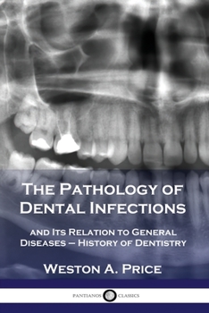 Paperback The Pathology of Dental Infections: and Its Relation to General Diseases - History of Dentistry Book