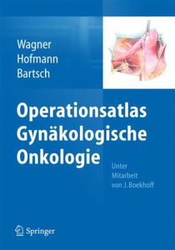 Operationsatlas Gynakologische Onkologie