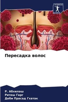 Paperback Пересадка волос [Russian] Book