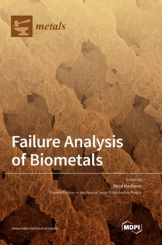 Hardcover Failure Analysis of Biometals Book