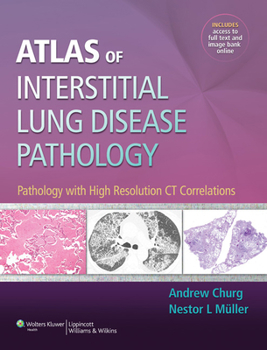 Hardcover Atlas of Interstitial Lung Disease Pathology: Pathology with High Resolution CT Correlations Book