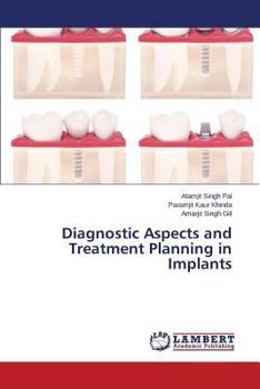 Paperback Diagnostic Aspects and Treatment Planning in Implants Book