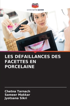 Paperback Les Défaillances Des Facettes En Porcelaine [French] Book