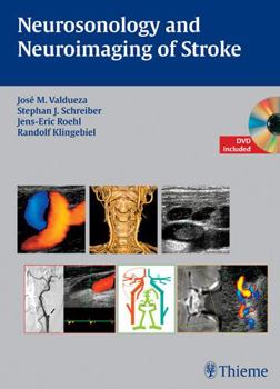 Hardcover Neurosonology and Neuroimaging of Stroke [With DVD] Book