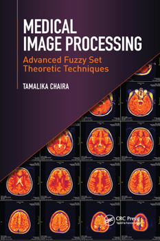 Paperback Medical Image Processing: Advanced Fuzzy Set Theoretic Techniques Book