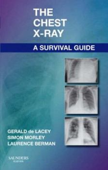 Paperback The Chest X-Ray: A Survival Guide Book