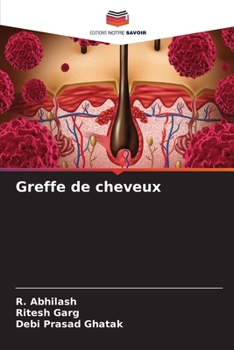 Paperback Greffe de cheveux [French] Book