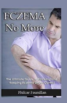 Paperback Eczema Cure: Eczema No More - The Ultimate Guide to Knowing and Keeping Eczema Under Control Book