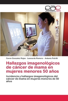 Paperback Hallazgos imagenológicos de cáncer de mama en mujeres menores 50 años [Spanish] Book