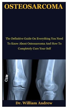 Paperback Osteosarcoma: The Definitive Guide On Everything You Need To Know About Osteosarcoma And How To Completely Cure Your Self Book
