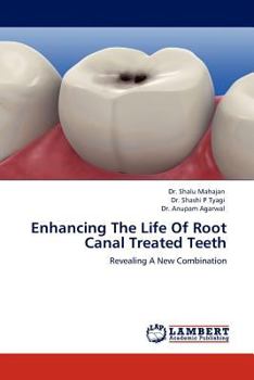 Paperback Enhancing The Life Of Root Canal Treated Teeth Book