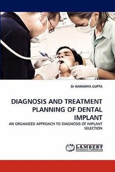 Paperback Diagnosis and Treatment Planning of Dental Implant Book