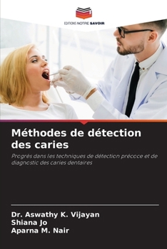 Paperback Méthodes de détection des caries [French] Book