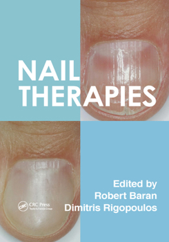 Paperback Nail Therapies Book