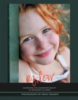 Aglow: Celebrating the Uncommon Beauty of Redheaded Children