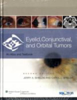 Hardcover Eyelid, Conjunctival, and Orbital Tumors and Intraocular Tumors: An Atlas and Text (Two-Volume Set) Book