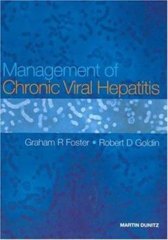 Paperback Management of Chronic Viral Hepatitis Book