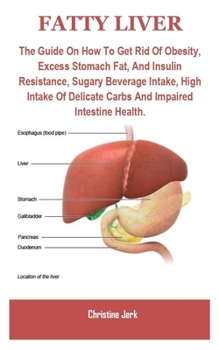 Fatty Liver: FATTY LIVER: The Guide On How To Get Rid Of Obesity, Excess Stomach Fat, And Insulin Resistance, Sugary Beverage Intake, High Intake Of Delicate Carbs And Impaired Intestine Health.