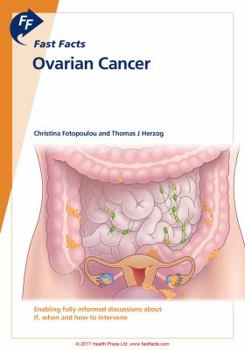 Paperback Fast Facts: Ovarian Cancer Book