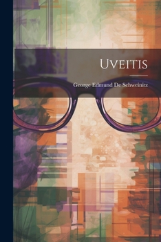 Paperback Uveitis Book